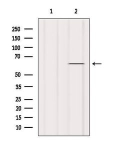 Invitrogen TAIP2 Polyclonal Antibody 100 &mu;L; Unconjugated:Antibodies,