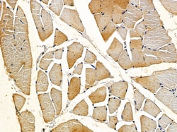Invitrogen MYL7 Polyclonal Antibody 100 &mu;L; Unconjugated:Antibodies,