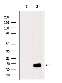 Invitrogen MYL7 Polyclonal Antibody 100 &mu;L; Unconjugated:Antibodies,