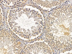 Invitrogen APC5 Polyclonal Antibody 100 &mu;L; Unconjugated:Antibodies,