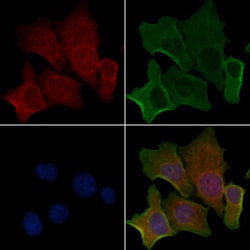 Invitrogen CNNM2 Polyclonal Antibody 100 &mu;L; Unconjugated:Antibodies,