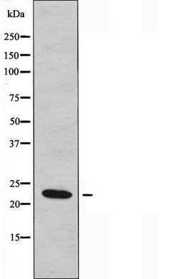 Invitrogen BCL7A Polyclonal Antibody 100 &mu;L | Buy Online | Invitrogen&trade; | Fisher Scientific