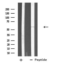 Invitrogen PTGIS Polyclonal Antibody 100 &mu;L; Unconjugated:Antibodies,
