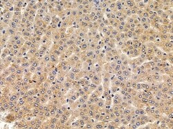 Invitrogen CYP4F11 Polyclonal Antibody 100 &mu;L | Buy Online | Invitrogen&trade; | Fisher Scientific