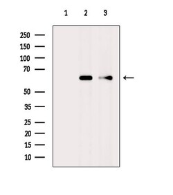 Invitrogen CYP4F11 Polyclonal Antibody 100 &mu;L | Buy Online | Invitrogen&trade; | Fisher Scientific