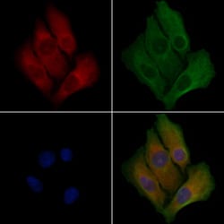 Invitrogen CYP20A1 Polyclonal Antibody 100 &mu;L; Unconjugated:Antibodies,