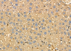Invitrogen CYP20A1 Polyclonal Antibody 100 &mu;L; Unconjugated:Antibodies,