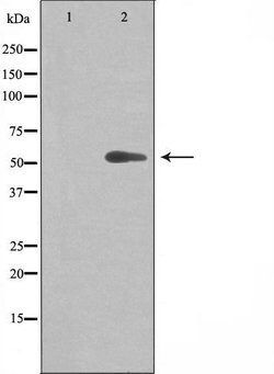 Invitrogen CYP20A1 Polyclonal Antibody 100 &mu;L; Unconjugated:Antibodies,