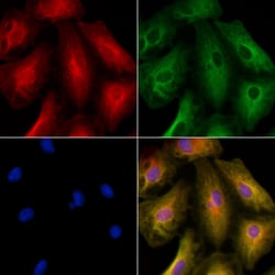 Invitrogen Kir2.3 (KCNJ4) Polyclonal Antibody 100 &mu;L; Unconjugated:Antibodies,