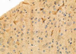 Invitrogen Kir2.3 (KCNJ4) Polyclonal Antibody 100 &mu;L; Unconjugated:Antibodies,