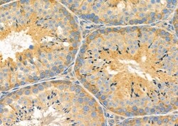 Invitrogen Kir2.3 (KCNJ4) Polyclonal Antibody 100 &mu;L; Unconjugated:Antibodies,