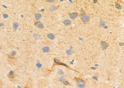 Invitrogen Kir2.3 (KCNJ4) Polyclonal Antibody 100 &mu;L; Unconjugated:Antibodies,