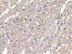 Invitrogen PHKG1 Polyclonal Antibody 100 &mu;L; Unconjugated:Antibodies,