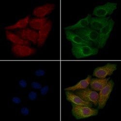 Invitrogen ACTBL2 Polyclonal Antibody 100 &mu;L; Unconjugated:Antibodies,
