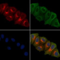 Invitrogen ERI1 Polyclonal Antibody 100 &mu;L; Unconjugated:Antibodies,