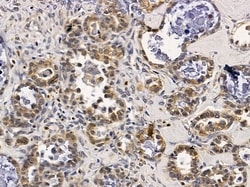 Invitrogen ERI1 Polyclonal Antibody 100 &mu;L; Unconjugated:Antibodies,