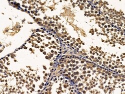 Invitrogen ERI1 Polyclonal Antibody 100 &mu;L; Unconjugated:Antibodies,