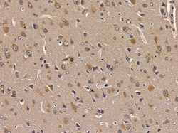 Invitrogen ERI1 Polyclonal Antibody 100 &mu;L; Unconjugated:Antibodies,