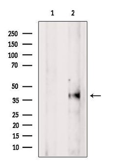 Invitrogen VASH1 Polyclonal Antibody 100 &mu;L; Unconjugated:Antibodies,