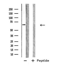 Invitrogen Glypican 5 Polyclonal Antibody 100 &mu;L | Buy Online | Invitrogen&trade; | Fisher Scientific