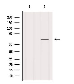 Invitrogen Glypican 5 Polyclonal Antibody 100 &mu;L | Buy Online | Invitrogen&trade; | Fisher Scientific