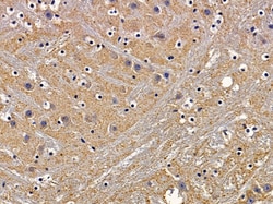 Invitrogen HTR5B Polyclonal Antibody 100 &mu;L; Unconjugated:Antibodies,
