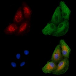 Invitrogen EDG6 Polyclonal Antibody 100 &mu;L | Buy Online | Invitrogen&trade; | Fisher Scientific