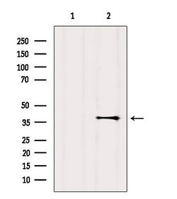 Invitrogen GPR119 Polyclonal Antibody 100 &mu;L; Unconjugated:Antibodies,