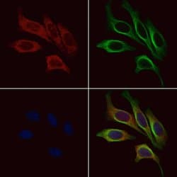 Invitrogen MC2R Polyclonal Antibody 100 &mu;L; Unconjugated:Antibodies,