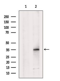Invitrogen MC2R Polyclonal Antibody 100 &mu;L; Unconjugated:Antibodies,