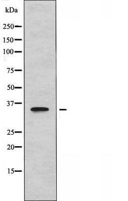 Invitrogen CYSLTR1 Polyclonal Antibody 100 &mu;L; Unconjugated:Antibodies,