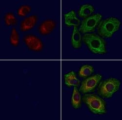 Invitrogen CYSLTR2 Polyclonal Antibody 100 &mu;L; Unconjugated:Antibodies,