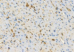 Invitrogen CYSLTR2 Polyclonal Antibody 100 &mu;L; Unconjugated:Antibodies,