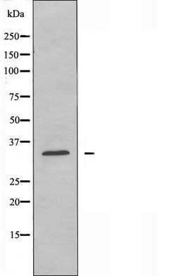 Invitrogen CYSLTR2 Polyclonal Antibody 100 &mu;L; Unconjugated:Antibodies,