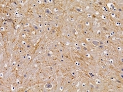 Invitrogen GPR156 Polyclonal Antibody 100 &mu;L; Unconjugated:Antibodies,