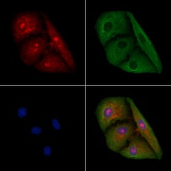 Invitrogen LGR6 Polyclonal Antibody 100 &mu;L; Unconjugated:Antibodies,