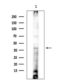 Invitrogen MC5R Polyclonal Antibody 100 &mu;L; Unconjugated:Antibodies,