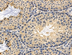 Invitrogen mPR alpha Polyclonal Antibody 100 &mu;L; Unconjugated:Antibodies,