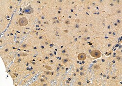 Invitrogen MC1R Polyclonal Antibody 100 &mu;L; Unconjugated:Antibodies,