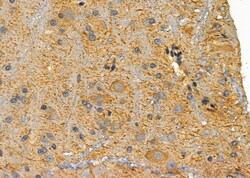 Invitrogen MC1R Polyclonal Antibody 100 &mu;L; Unconjugated:Antibodies,