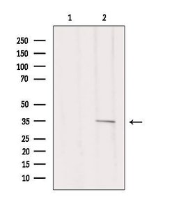 Invitrogen MC1R Polyclonal Antibody 100 &mu;L; Unconjugated:Antibodies,