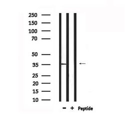 Invitrogen MC1R Polyclonal Antibody 100 &mu;L; Unconjugated:Antibodies,