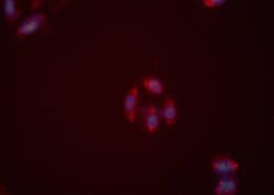 Invitrogen NPY2R Polyclonal Antibody 100 &mu;L; Unconjugated:Antibodies,