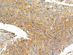 Invitrogen NPY2R Polyclonal Antibody 100 &mu;L; Unconjugated:Antibodies,