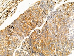 Invitrogen NPY2R Polyclonal Antibody 100 &mu;L; Unconjugated:Antibodies,