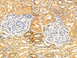 Invitrogen NPY2R Polyclonal Antibody 100 &mu;L; Unconjugated:Antibodies,