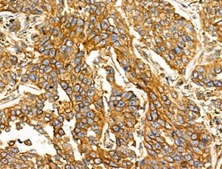 Invitrogen NPY2R Polyclonal Antibody 100 &mu;L; Unconjugated:Antibodies,