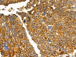 Invitrogen NPY2R Polyclonal Antibody 100 &mu;L; Unconjugated:Antibodies,