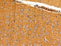Invitrogen NPY2R Polyclonal Antibody 100 &mu;L; Unconjugated:Antibodies,
