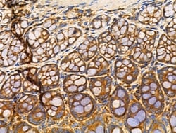 Invitrogen NPY2R Polyclonal Antibody 100 &mu;L; Unconjugated:Antibodies,